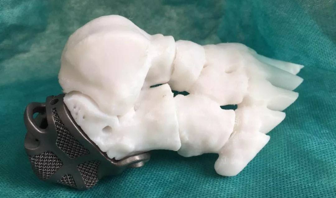 定制式個性化骨植入物等效性模型注冊技術審查指導原則(2020年第48號)(圖1) 定制式個性化骨植入物等效性模型注冊技術審查指導原則(2020年第48號)(圖1)